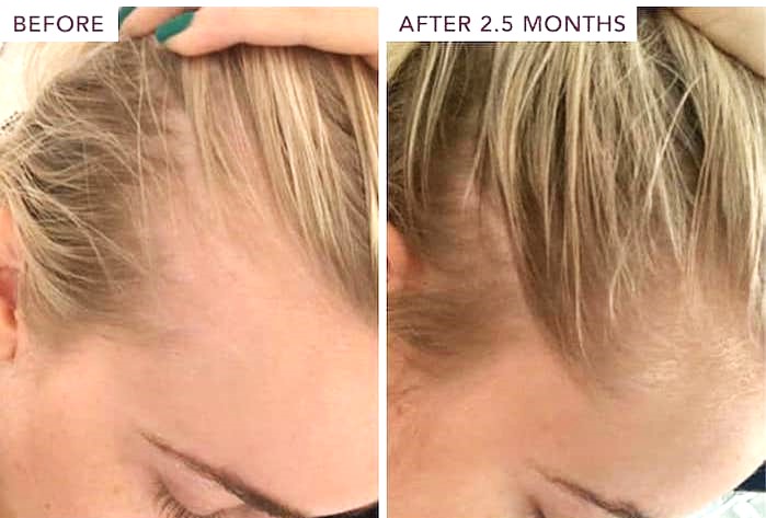 before and after batana oil